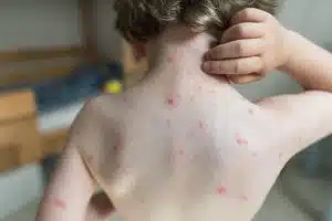 littleton pediatricians