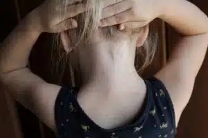 Common Summer Time Skin Rashes