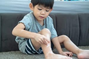 Pediatric Eczema: Symptoms, Causes & Treatment