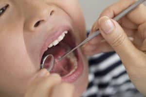 Gum Disease in Children