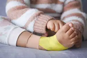 Pediatric Fractures